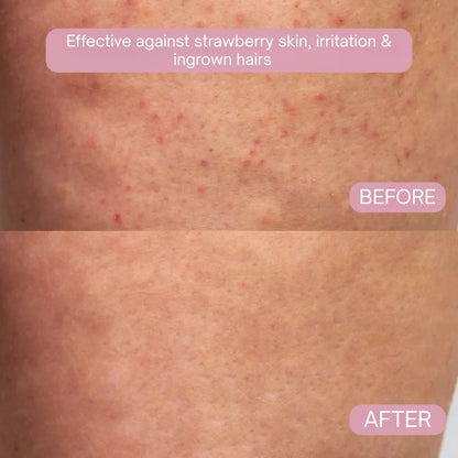 Glisse Pro Spring Starter Set