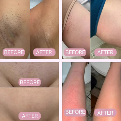 Glisse Pro Spring Starter Set